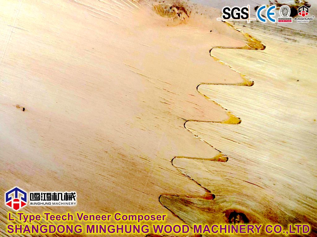 L type Veneer Teech Composer