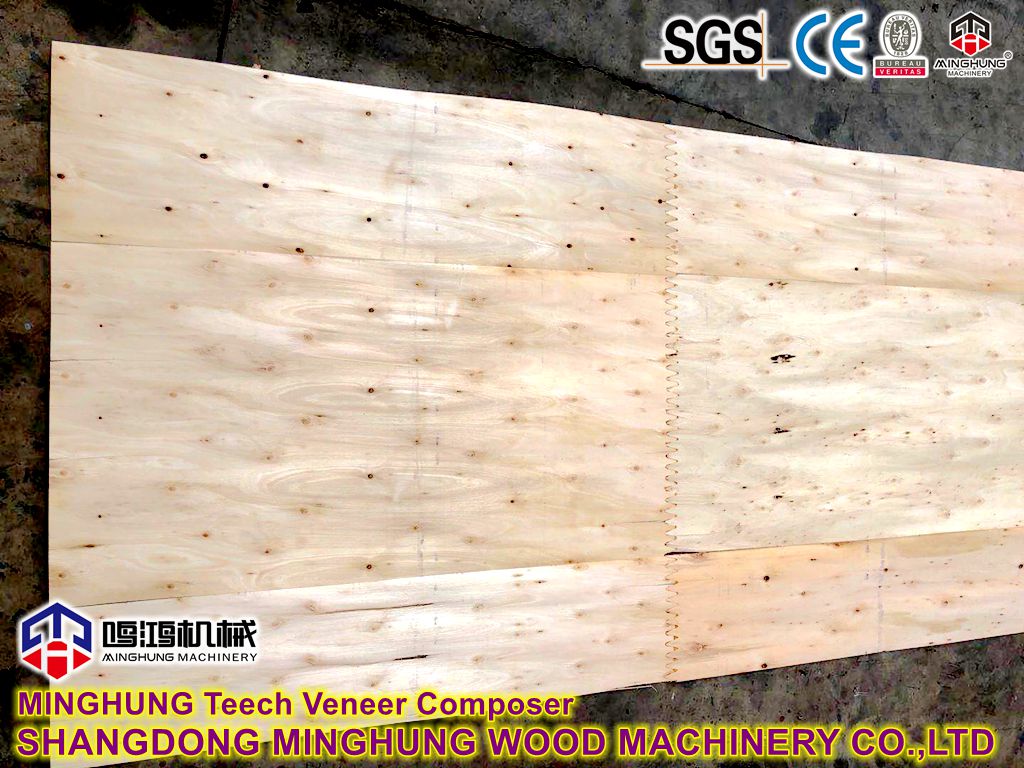 Veneer Teech Composer